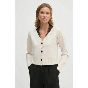 Sisley cardigan din lana culoarea bej, 1M9AM6026 imagine