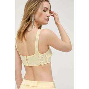 Patrizia Pepe top imagine